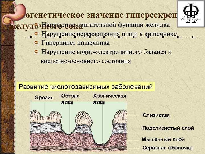 Патогенетическое значение гиперсекреции Нарушение двигательной функции желудка желудочного сока Нарушение переваривания пищи в кишечнике