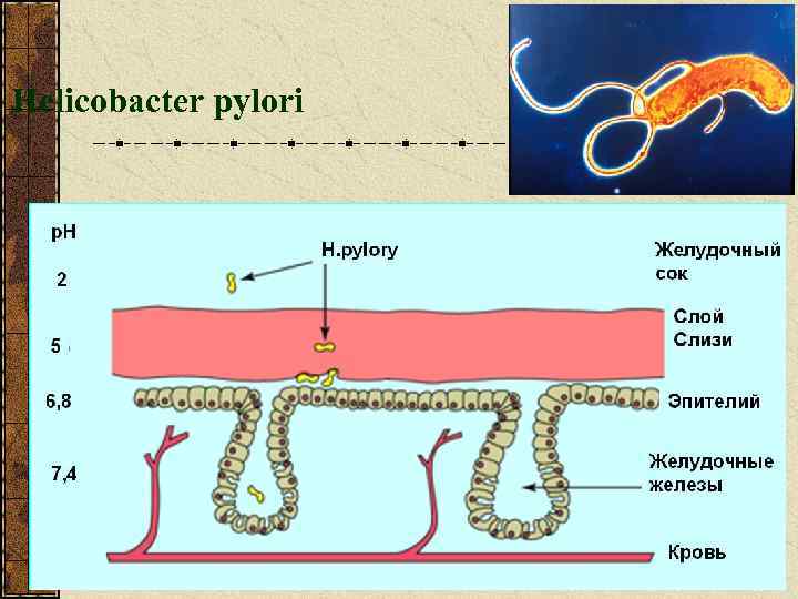 Helicobacter pylori 