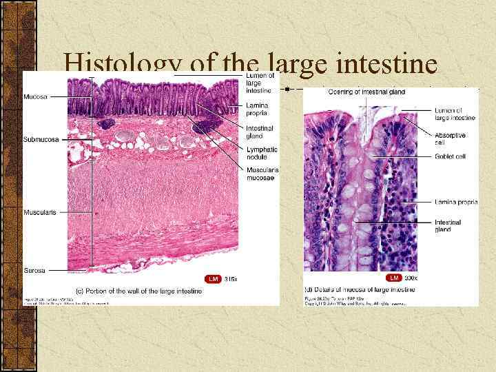 Histology of the large intestine 