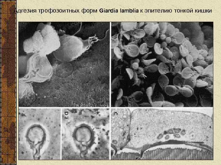 Адгезия трофозоитных форм Giardia lamblia к эпителию тонкой кишки 