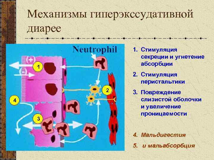 Механизмы гиперэкссудативной диарее 1. Стимуляция секреции и угнетение абсорбции 1 2. Стимуляция перистальтики 2