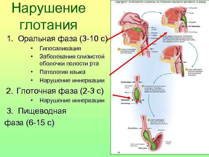 Нарушение глотания 1. Оральная фаза (3 -10 с) • • Гипосаливация Заболевания слизистой оболочки