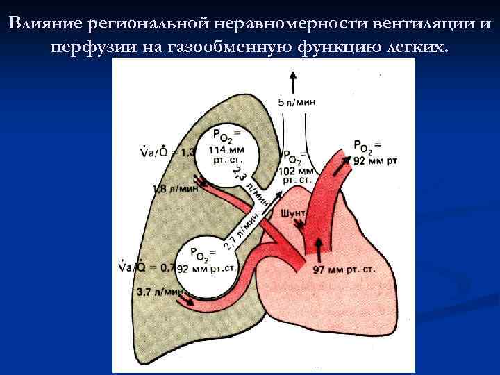 Влияние региональной неравномерности вентиляции и перфузии на газообменную функцию легких. 