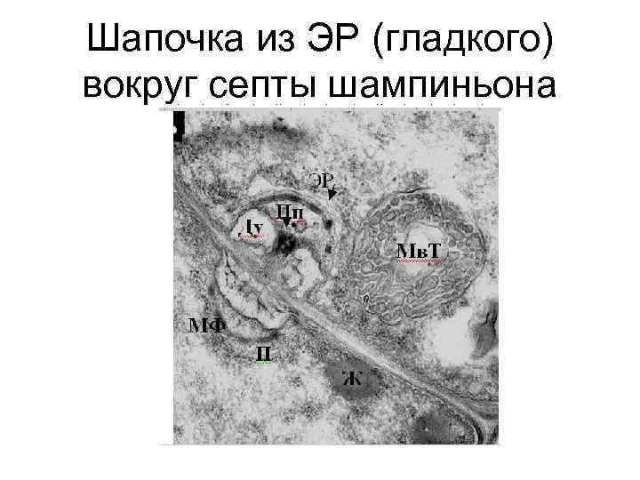 Шапочка из ЭР (гладкого) вокруг септы шампиньона 
