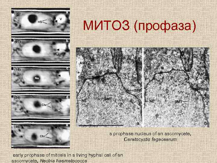 МИТОЗ (профаза) a prophase nucleus of an ascomycete, Ceratocystis fagacearum early prophase of mitosis