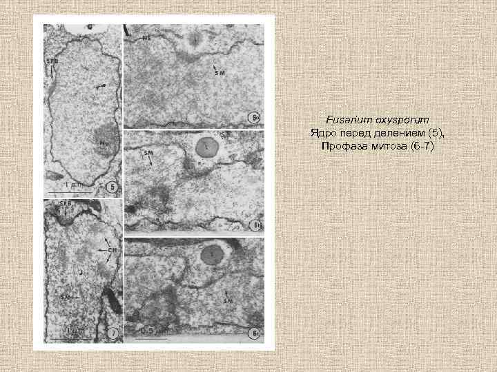 Fusarium oxysporum Ядро перед делением (5), Профаза митоза (6 -7) 