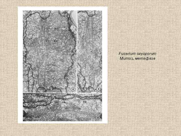 Fusarium oxysporum Митоз, метафаза 