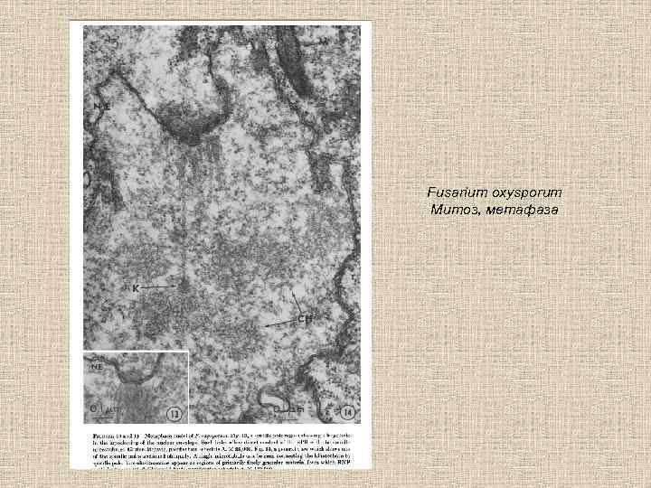 Fusarium oxysporum Митоз, метафаза 