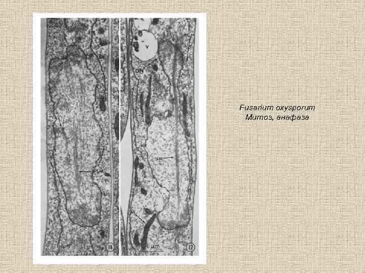 Fusarium oxysporum Митоз, анафаза 