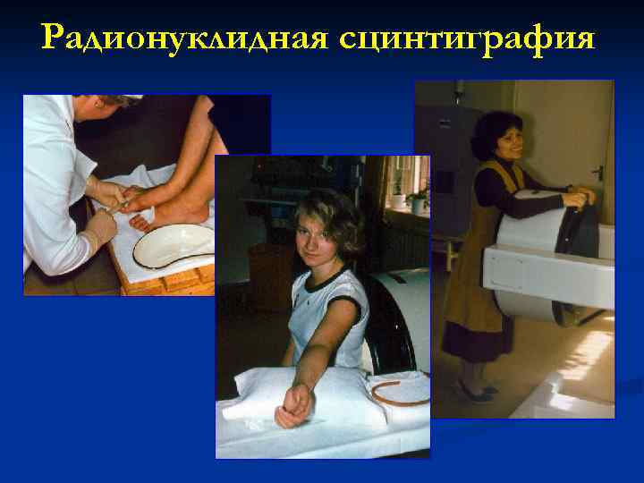 Радионуклидная сцинтиграфия 