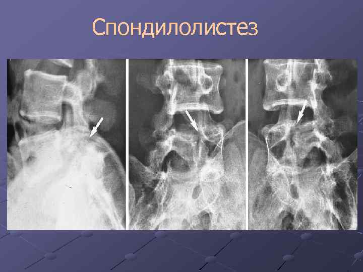 Лучевая диагностика позвоночник презентация