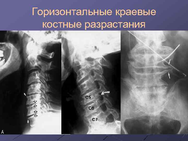 Лучевая диагностика позвоночник презентация