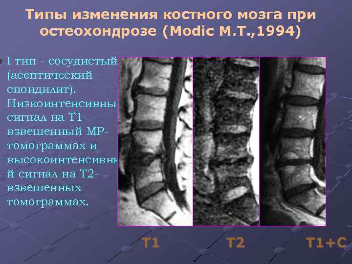 Лучевая диагностика позвоночник презентация