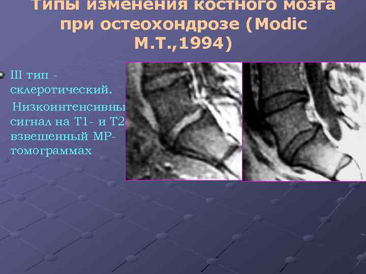 Лучевая диагностика позвоночник презентация