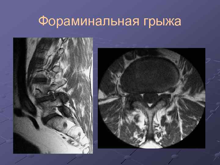 Лучевая диагностика позвоночник презентация