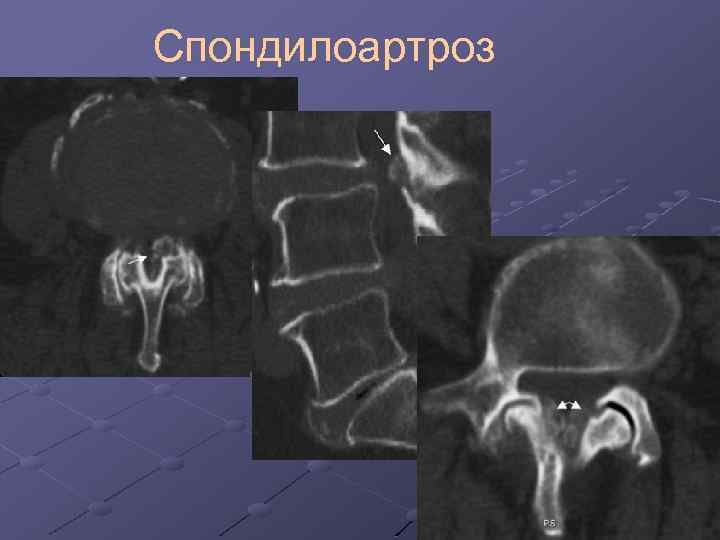 Лучевая диагностика позвоночник презентация