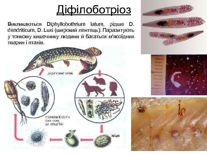 Діфілоботріоз Викликаються Diphyllobothrium latum, рідше D. dendriticum, D. Luxi (широкий лентець). Паразитують у тонкому