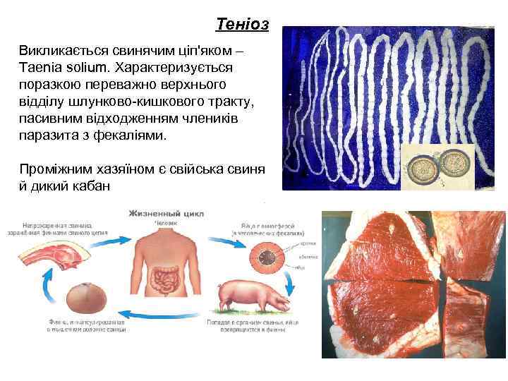 Теніоз Викликається свинячим ціп'яком – Taenia solium. Характеризується поразкою переважно верхнього відділу шлунково-кишкового тракту,