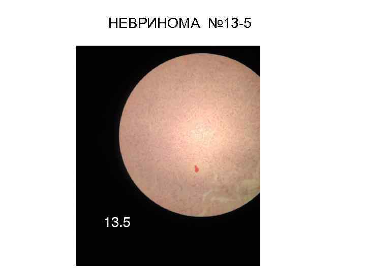 НЕВРИНОМА № 13 -5 