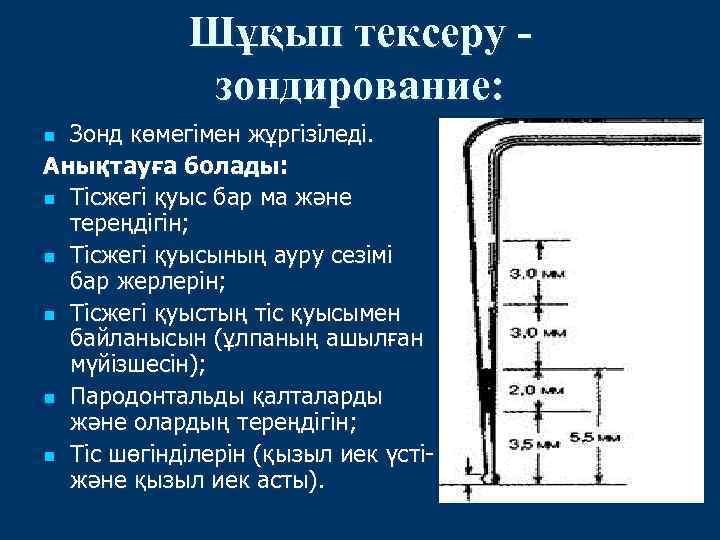 Шұқып тексеру зондирование: Зонд көмегімен жұргізіледі. Анықтауға болады: n Тісжегі қуыс бар ма және