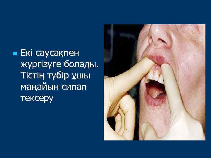 n Екі саусақпен жүргізуге болады. Тістің түбір ұшы маңайын сипап тексеру 