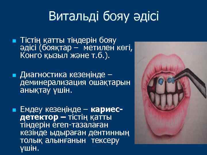 Витальді бояу әдісі n n n Тістің қатты тіндерін бояу әдісі (бояқтар – метилен