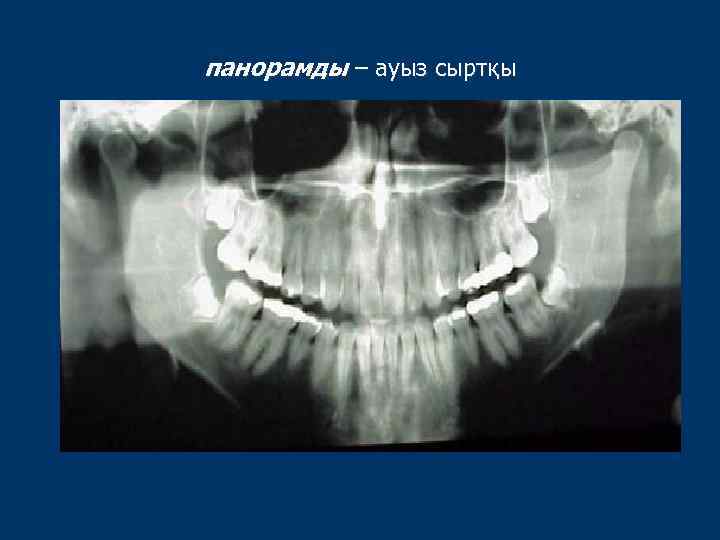 панорамды – ауыз сыртқы 
