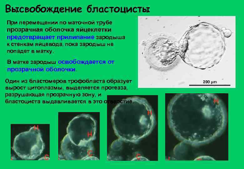 Высвобождение бластоцисты При перемещении по маточной трубе прозрачная оболочка яйцеклетки предотвращает прилипание зародыша к