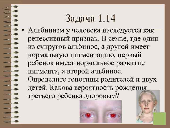  Задача 1. 14 • Альбинизм у человека наследуется как рецессивный признак. В семье,