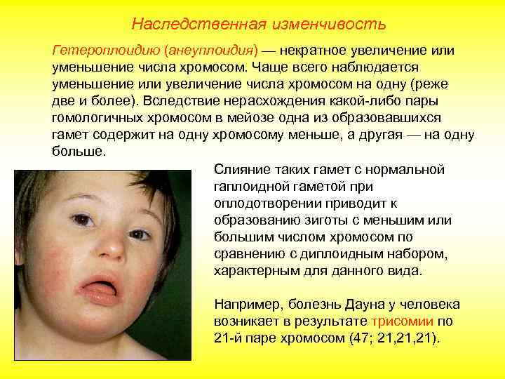 Наследственная изменчивость Гетероплоидию (анеуплоидия) — некратное увеличение или уменьшение числа хромосом. Чаще всего наблюдается