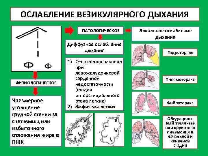 Везикулярное дыхание схема