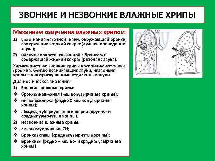ЗВОНКИЕ И НЕЗВОНКИЕ ВЛАЖНЫЕ ХРИПЫ Механизм озвучения влажных хрипов: 1) уплотнение легочной ткани, окружающей