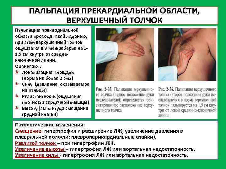 ПАЛЬПАЦИЯ ПРЕКАРДИАЛЬНОЙ ОБЛАСТИ, ВЕРХУШЕЧНЫЙ ТОЛЧОК Пальпацию прекардиальной области проводят всей ладонью, при этом верхушечный