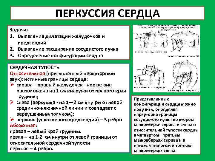 Перкуссия относительной тупости сердца