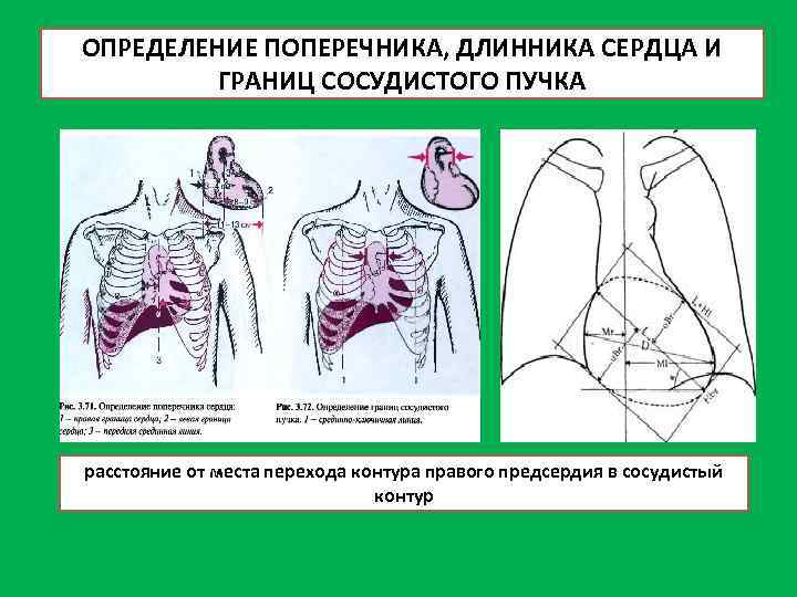 Поперечник