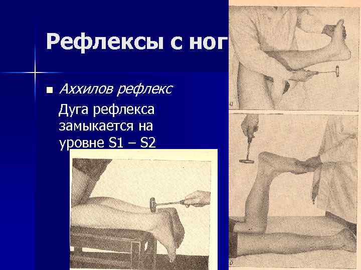 Рефлексы с ног n Аххилов рефлекс Дуга рефлекса замыкается на уровне S 1 –