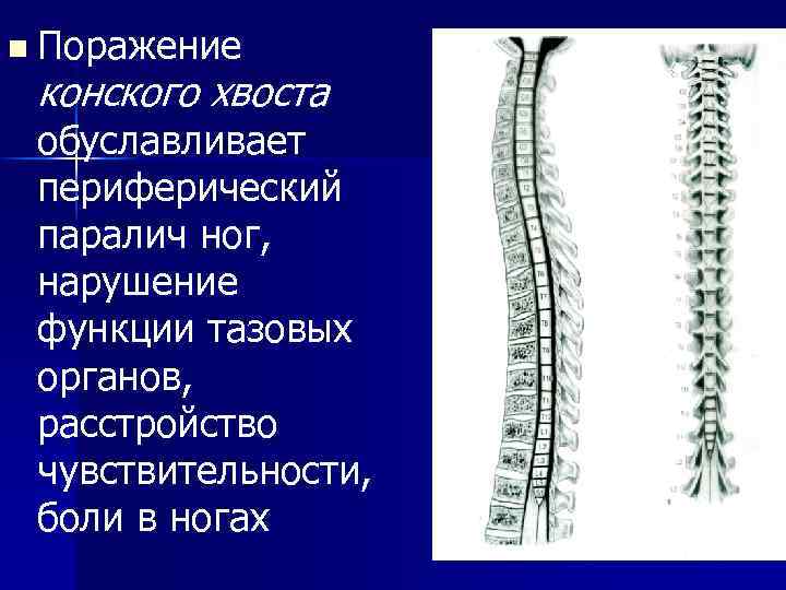 n Поражение конского хвоста обуславливает периферический паралич ног, нарушение функции тазовых органов, расстройство чувствительности,