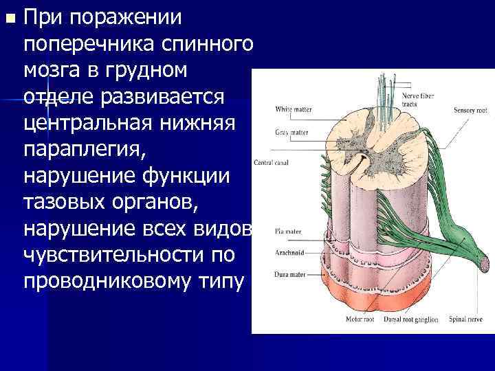 n При поражении поперечника спинного мозга в грудном отделе развивается центральная нижняя параплегия, нарушение