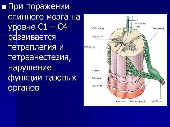 n При поражении спинного мозга на уровне С 1 – С 4 развивается тетраплегия