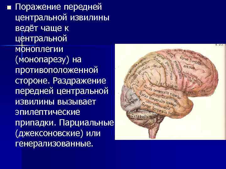 n Поражение передней центральной извилины ведёт чаще к центральной моноплегии (монопарезу) на противоположенной стороне.