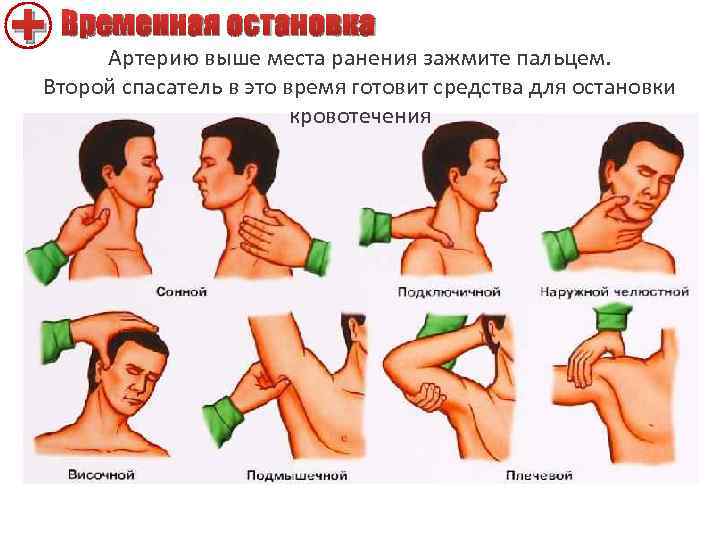 + Временная остановка Артерию выше места ранения зажмите пальцем. Второй спасатель в это время