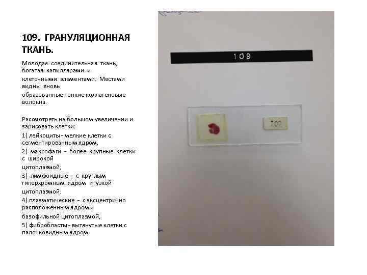 109. ГРАНУЛЯЦИОННАЯ ТКАНЬ. Молодая соединительная ткань, богатая капиллярами и клеточными элементами. Местами видны вновь