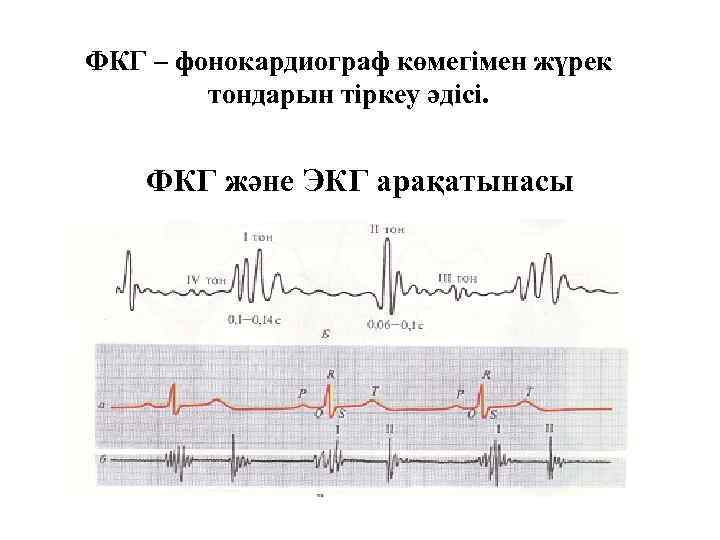 ФКГ – фонокардиограф көмегімен жүрек тондарын тіркеу әдісі. ФКГ және ЭКГ арақатынасы 