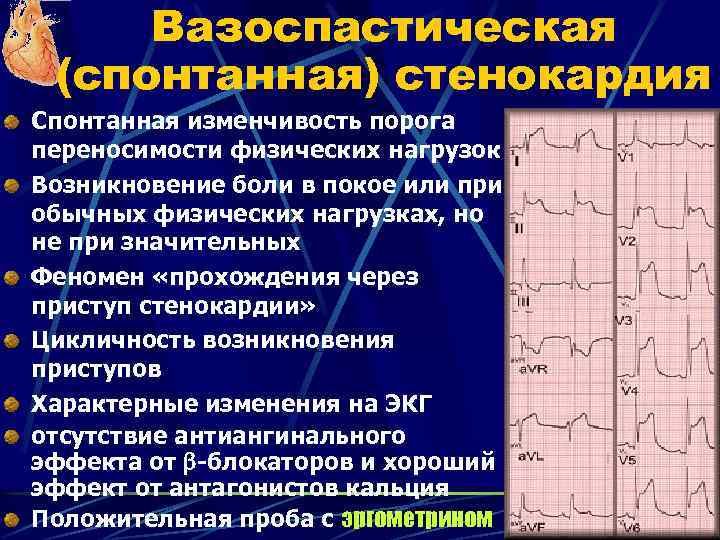 Вазоспастическая (спонтанная) стенокардия Спонтанная изменчивость порога переносимости физических нагрузок Возникновение боли в покое или