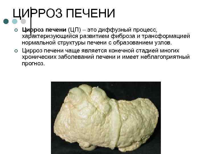 ЦИРРОЗ ПЕЧЕНИ ¢ ¢ Цирроз печени (ЦП) – это диффузный процесс, характеризующийся развитием фиброза