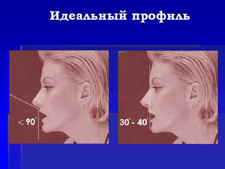 Идеальный профиль 