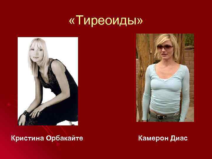  «Тиреоиды» Кристина Орбакайте Камерон Диас 