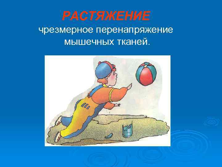 РАСТЯЖЕНИЕ чрезмерное перенапряжение мышечных тканей. 