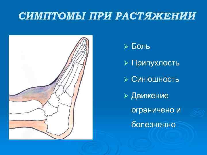 СИМПТОМЫ ПРИ РАСТЯЖЕНИИ Ø Боль Ø Припухлость Ø Синюшность Ø Движение ограничено и болезненно