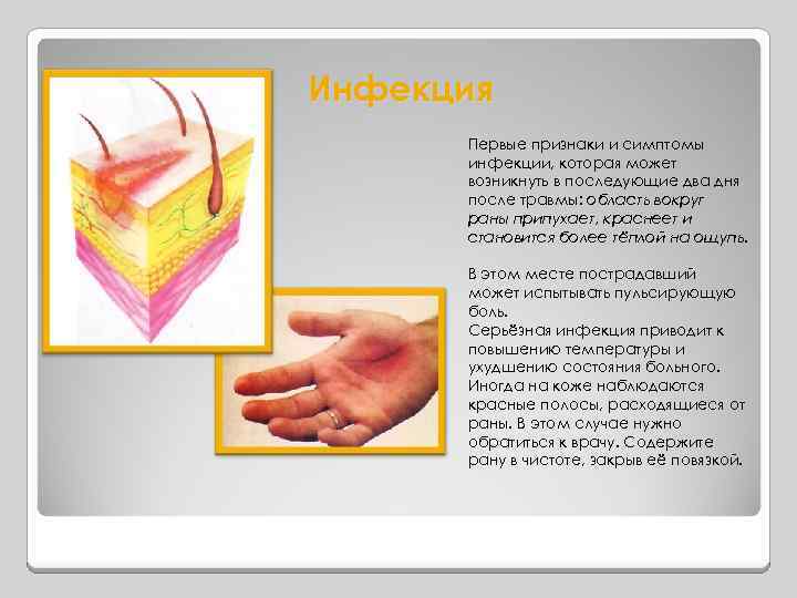 Инфекция Первые признаки и симптомы инфекции, которая может возникнуть в последующие два дня после